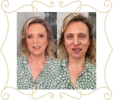before-after-night-5
