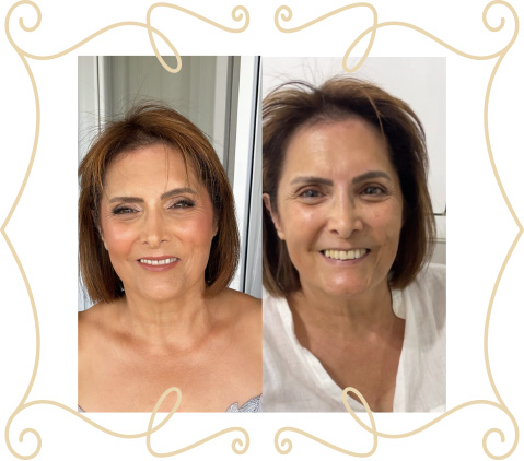 before-after-night-7