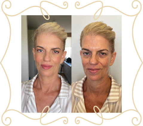before-after-slide-1