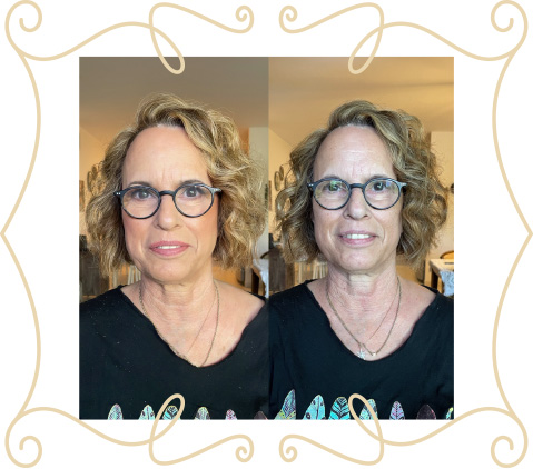 before-after-slide-2