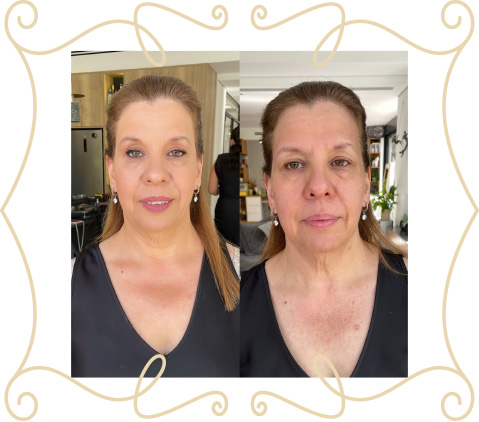 before-after-slide-3