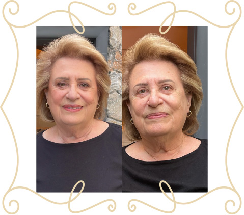 before-after-slide-4