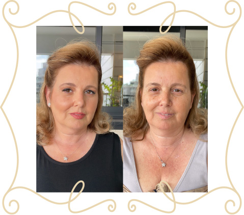 before-after-slide-5