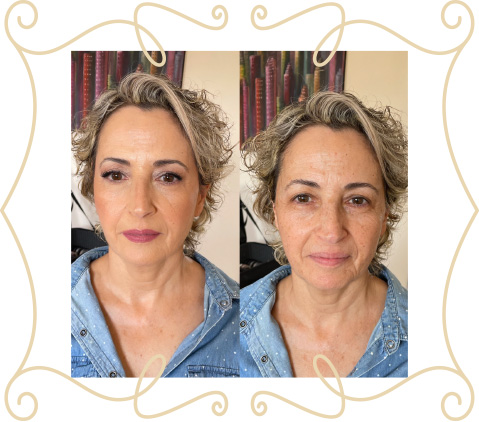 before-after-slide-6